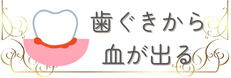歯ぐきからの出血でお悩みの方はこちら