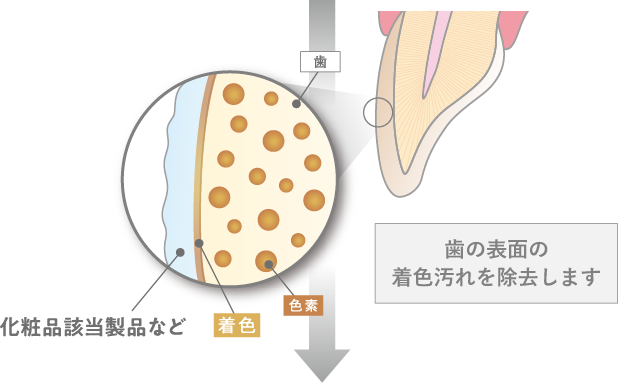 セルフホワイトニングは、歯の表面の汚れを除去
