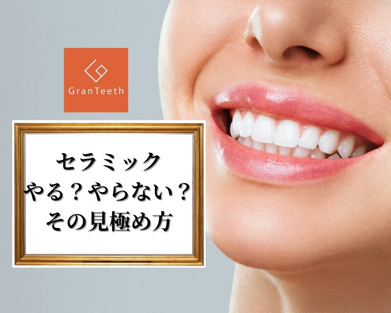 セラミック やる？やらない？ その見極め方