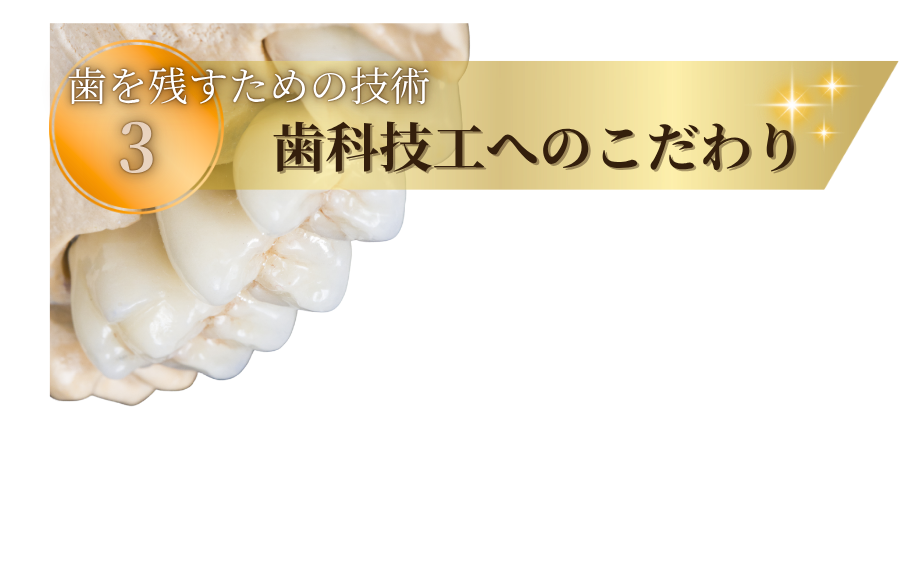 歯を残すための技術3:歯科技工へのこだわり