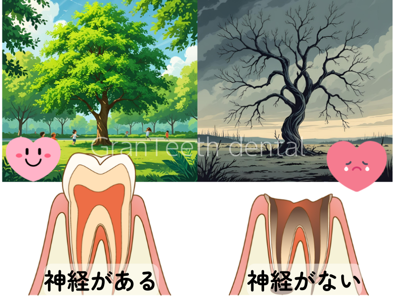 歯の神経をとると枯れ木のような状態になる