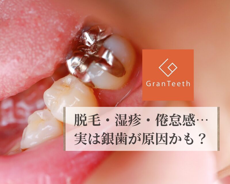 金属アレルギーのアイキャッチ画像