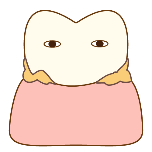 プラーク