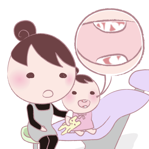磨き残しチェック